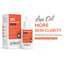 10% Niacinamide Face Serum for Oil Control, Pores & Glow
