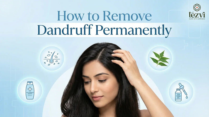 How to Remove Dandruff Permanently - Treatments and Home Remedies