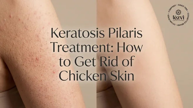 Keratosis Pilaris Treatment