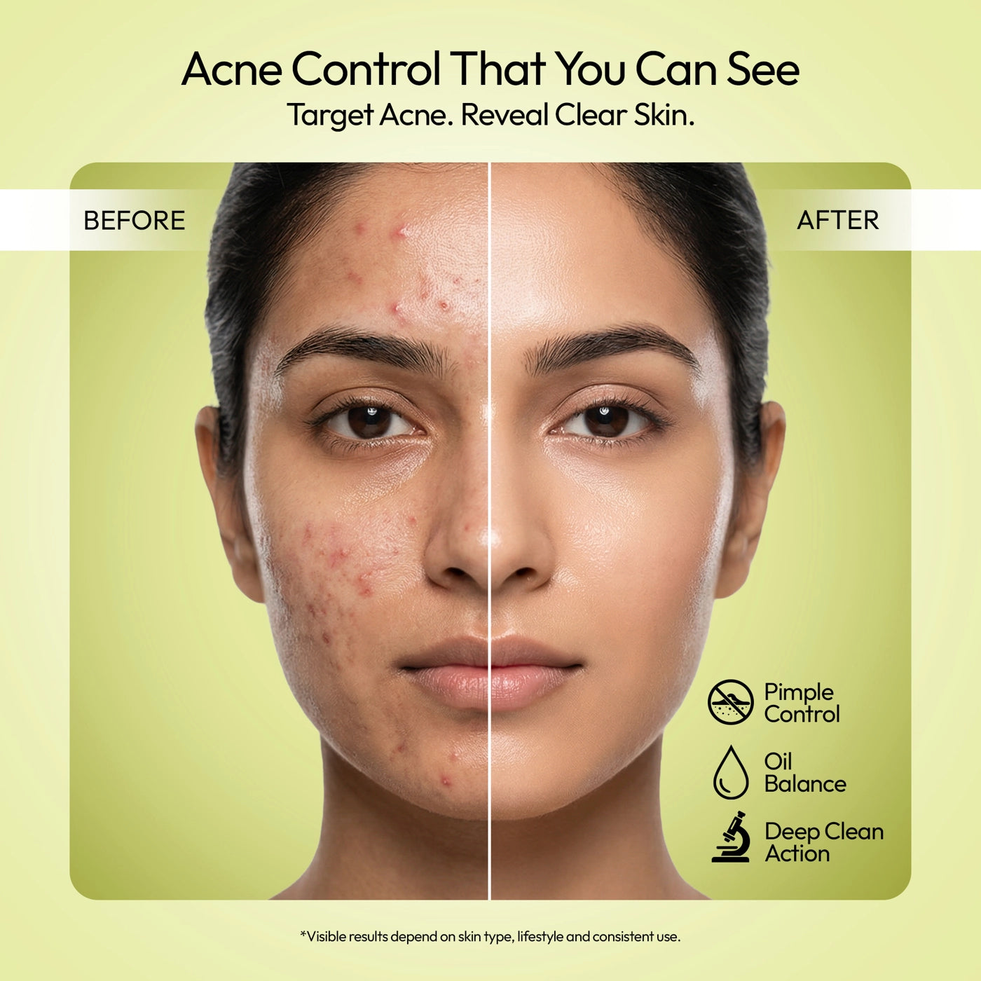 Blemish Control Face Serum for Clear Skin - 3X Repair Formula Secondary image