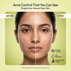 Blemish Control Face Serum