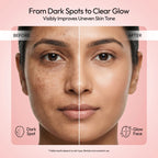 Dark Spot Serum