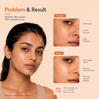 Niacinamide Face Serum Problem Results