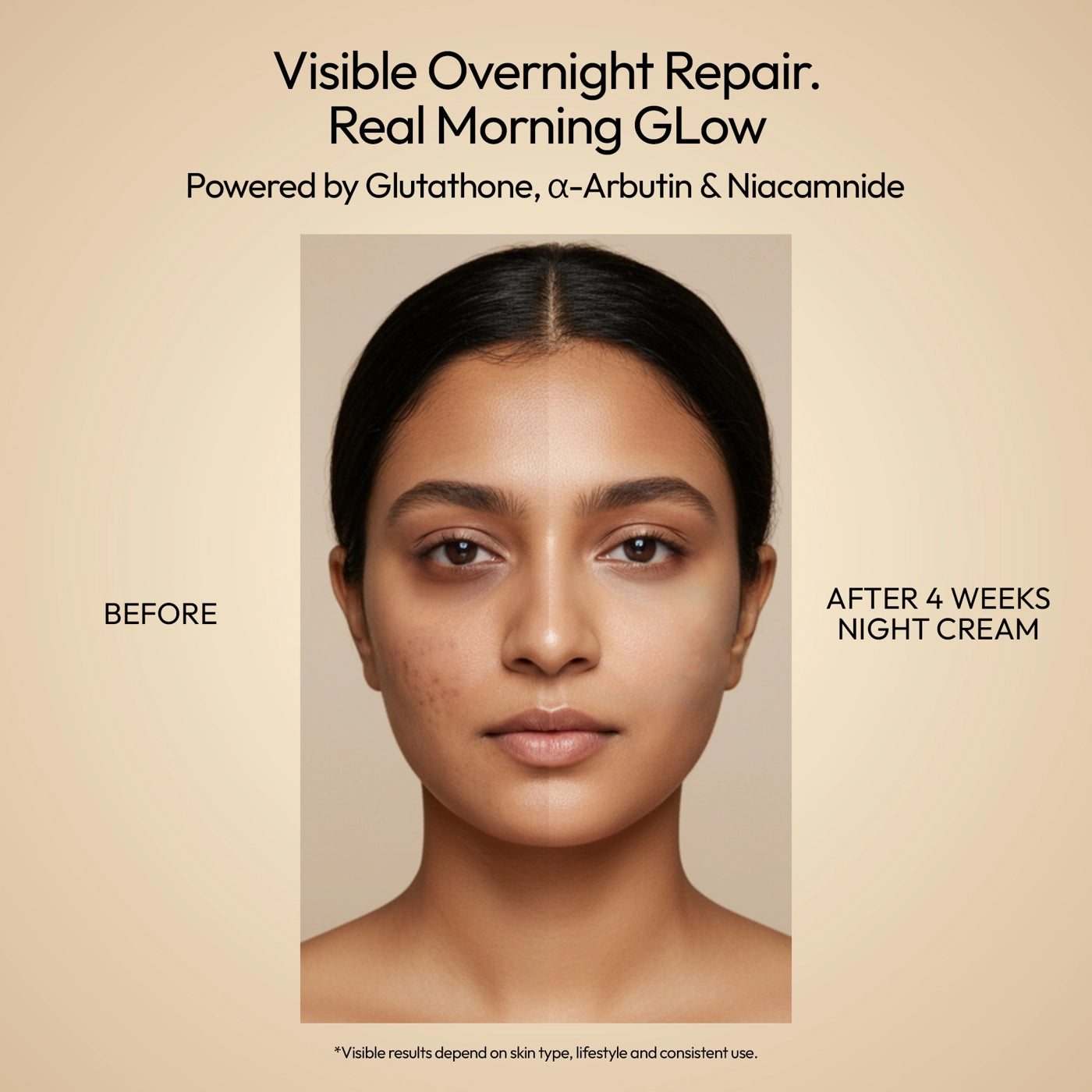 Night Cream for Pigmentation & Dark Spots - Advanced Skin Repair Secondary image
