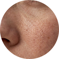 Open Pores