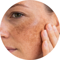 Pigmentation