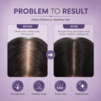 Rosemary Water Hair Spray with Rice Ferment | Hair Growth Spray