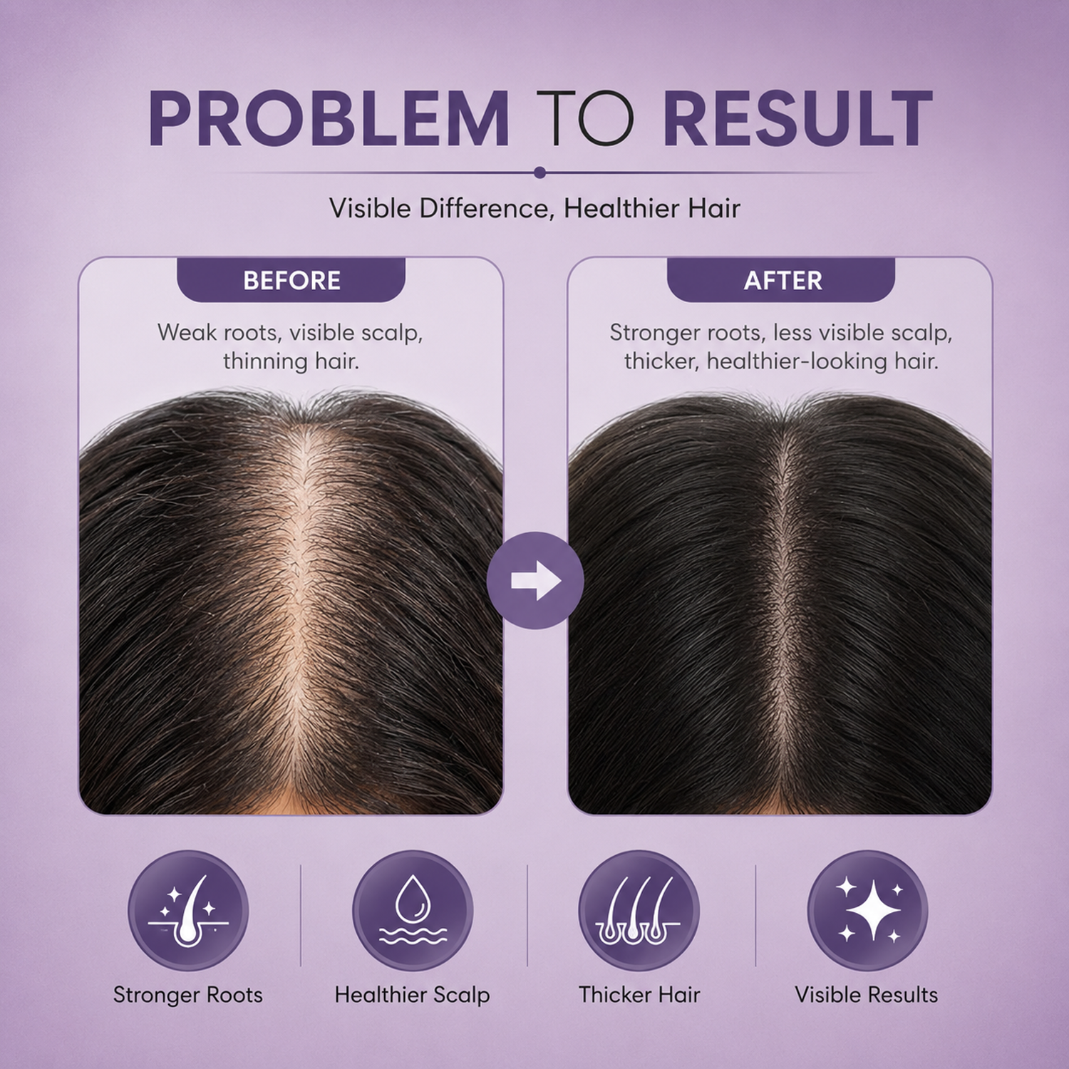 Rosemary Water Hair Spray with Rice Ferment | Hair Growth Spray