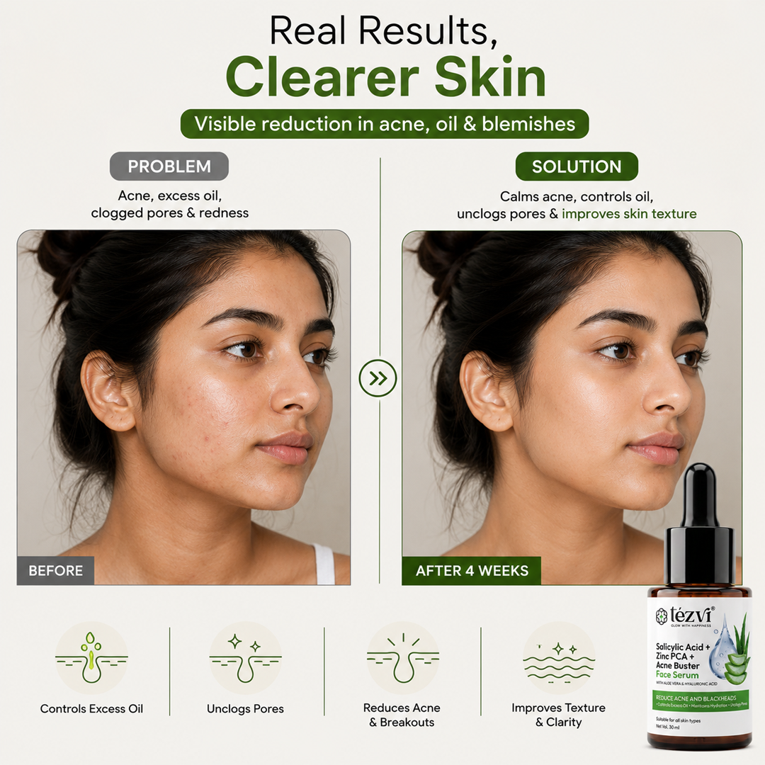 Salicylic Acid Face Serum for Blackheads & Clear Skin