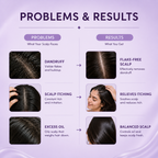 Scalp Care Shampoo | Dandruff & Flake Control Shampoo for Itchy