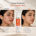 Skin Clarifying Gel with Niacinamide for Oil Control & Pores