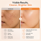 Tranexamic Acid Face Serum for Dark Spots & Even Tone