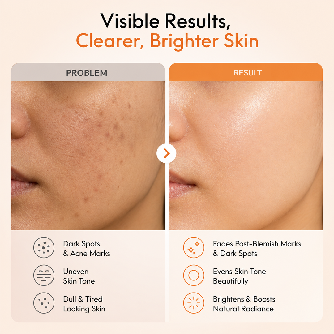 Tranexamic Acid Face Serum for Dark Spots & Even Tone