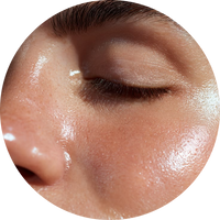 Oily Skin