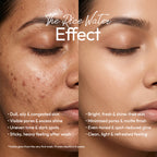rice-water-face-wash_3