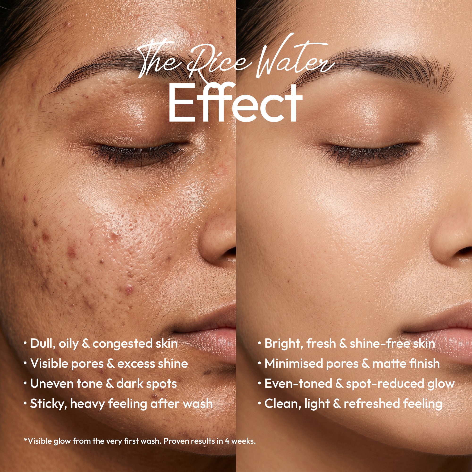 rice-water-face-wash_3